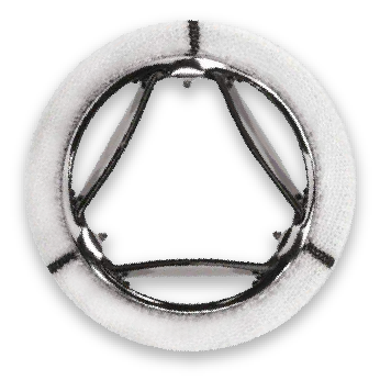 A trileaflet heart valve (Source: https://www.novostia.com/patient-benefits)